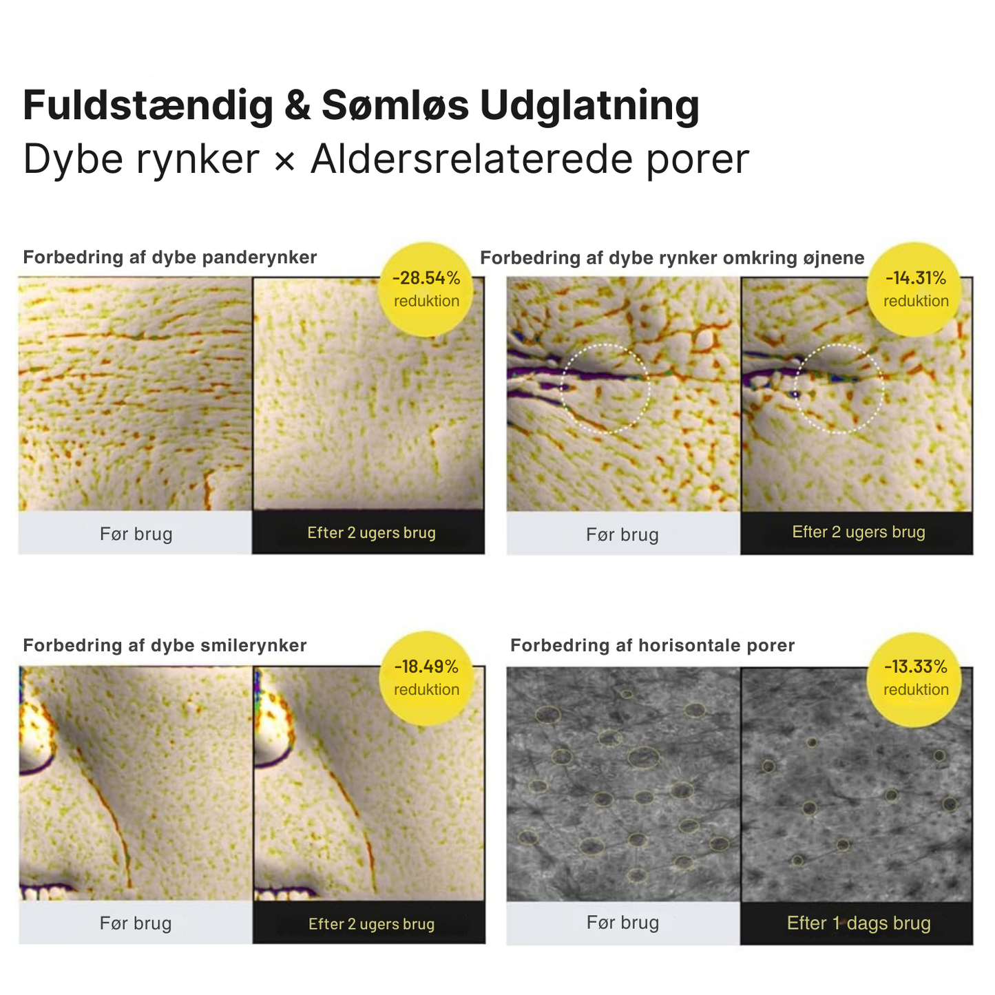 Vita-A Opstrammende Sæt (Serum + Booster)