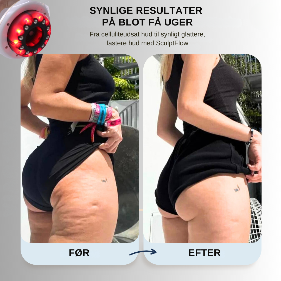 SculptFlow | Dybdegående massage for lettere ben & glattere hud