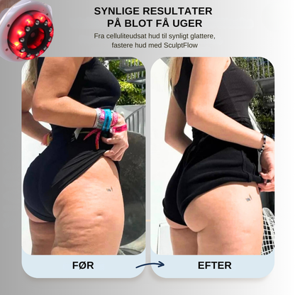 SculptFlow | Dybdegående massage for lettere ben & glattere hud