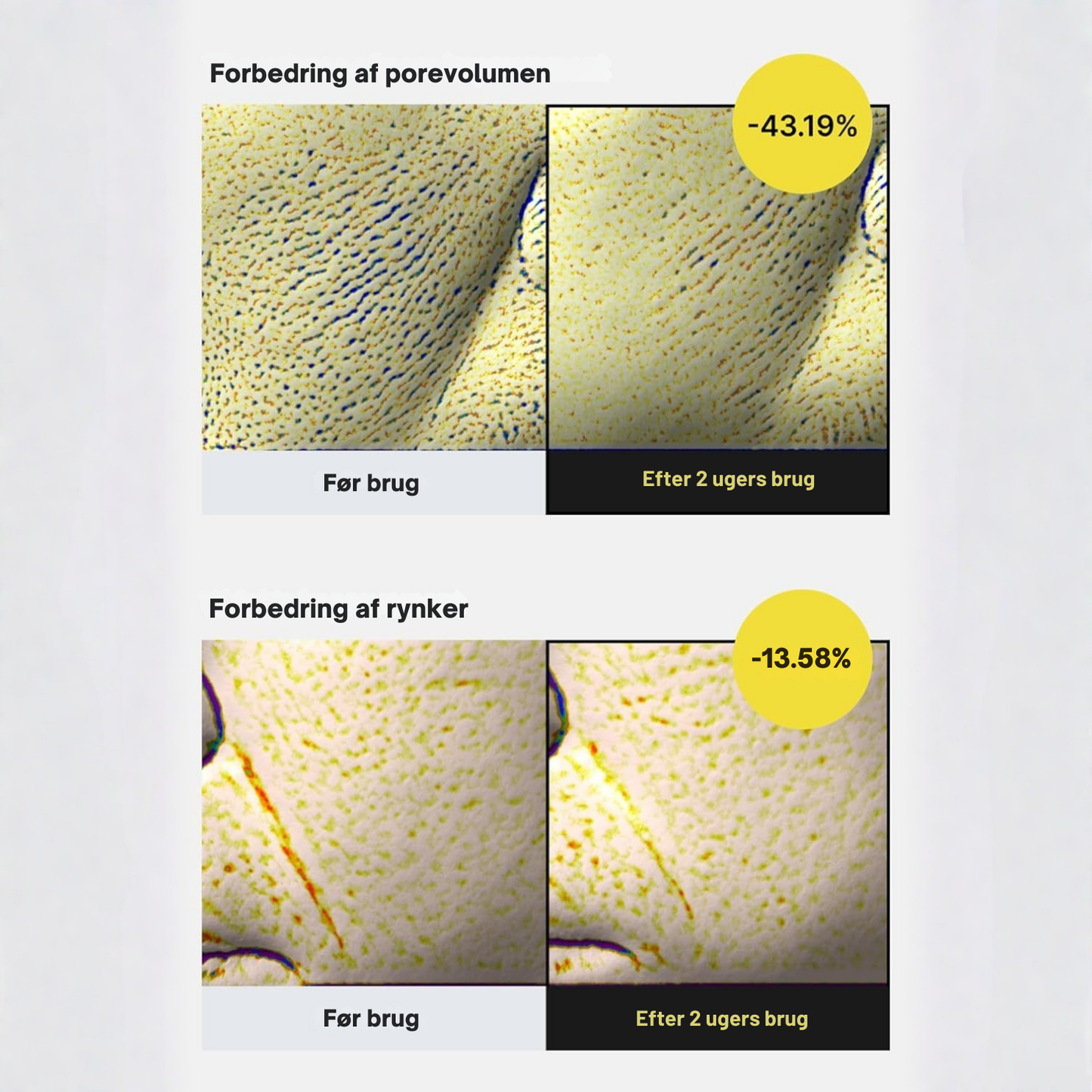 Vita-A Opstrammende Sæt (Serum + Booster)